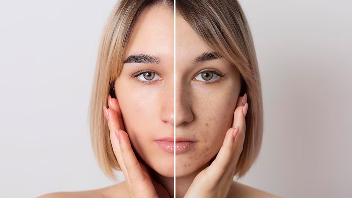 glowing skin vs dull skin